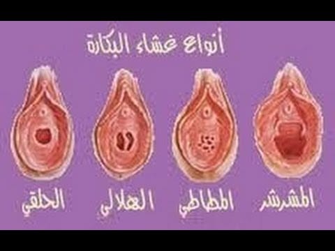 غشاء البكارة