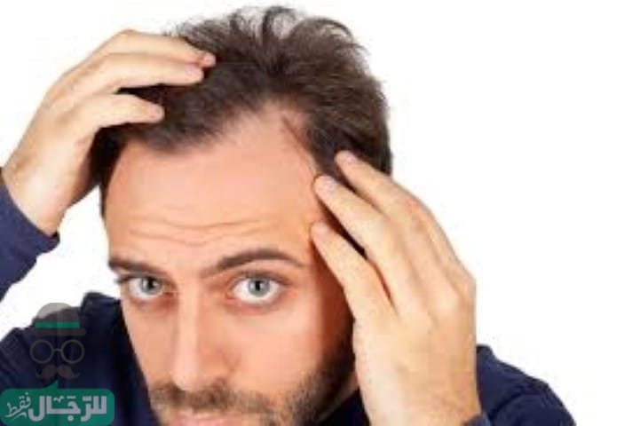 زراعة الشعر في اسطنبول
