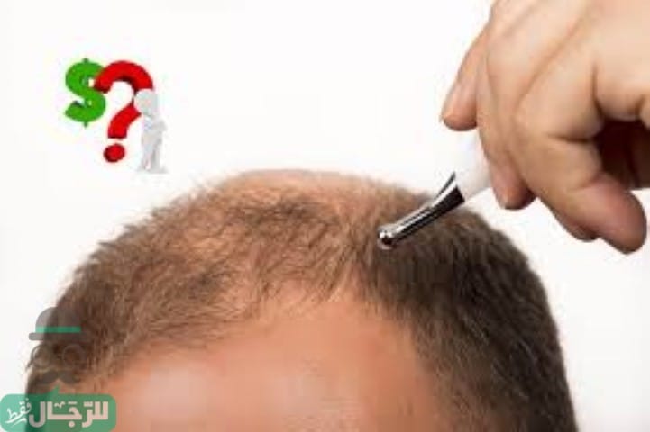 زراعة الشعر في الكويت